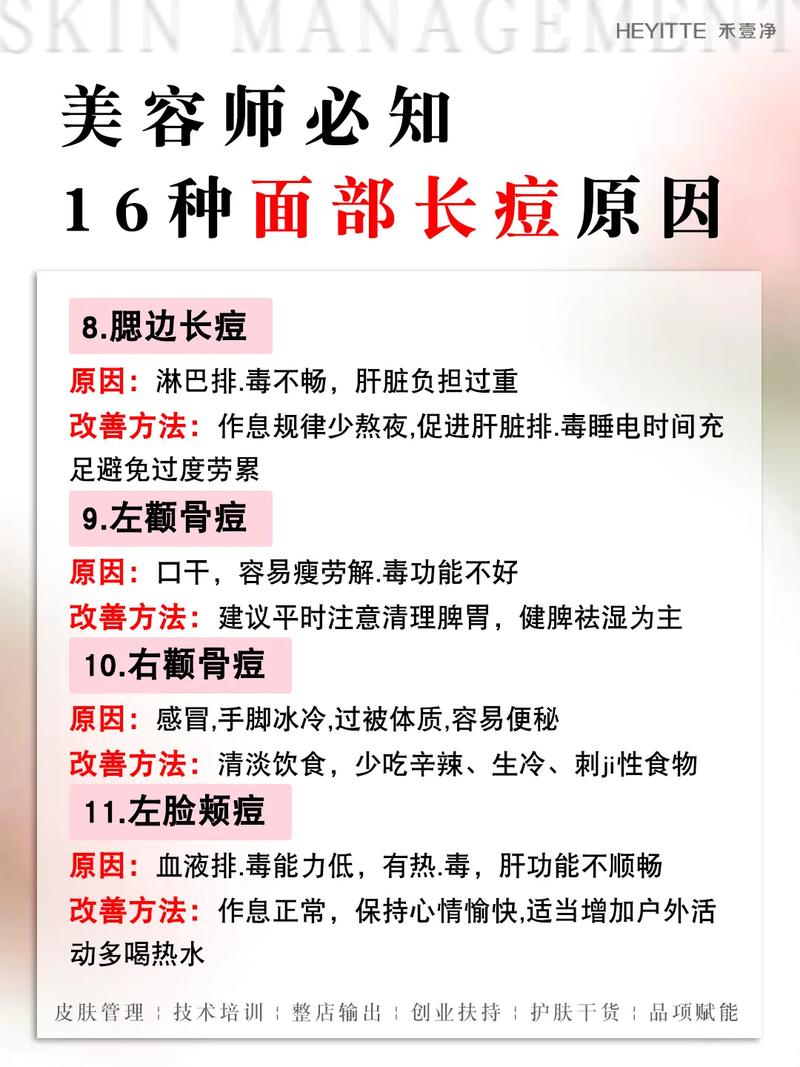 脸上长痘痘看什么科