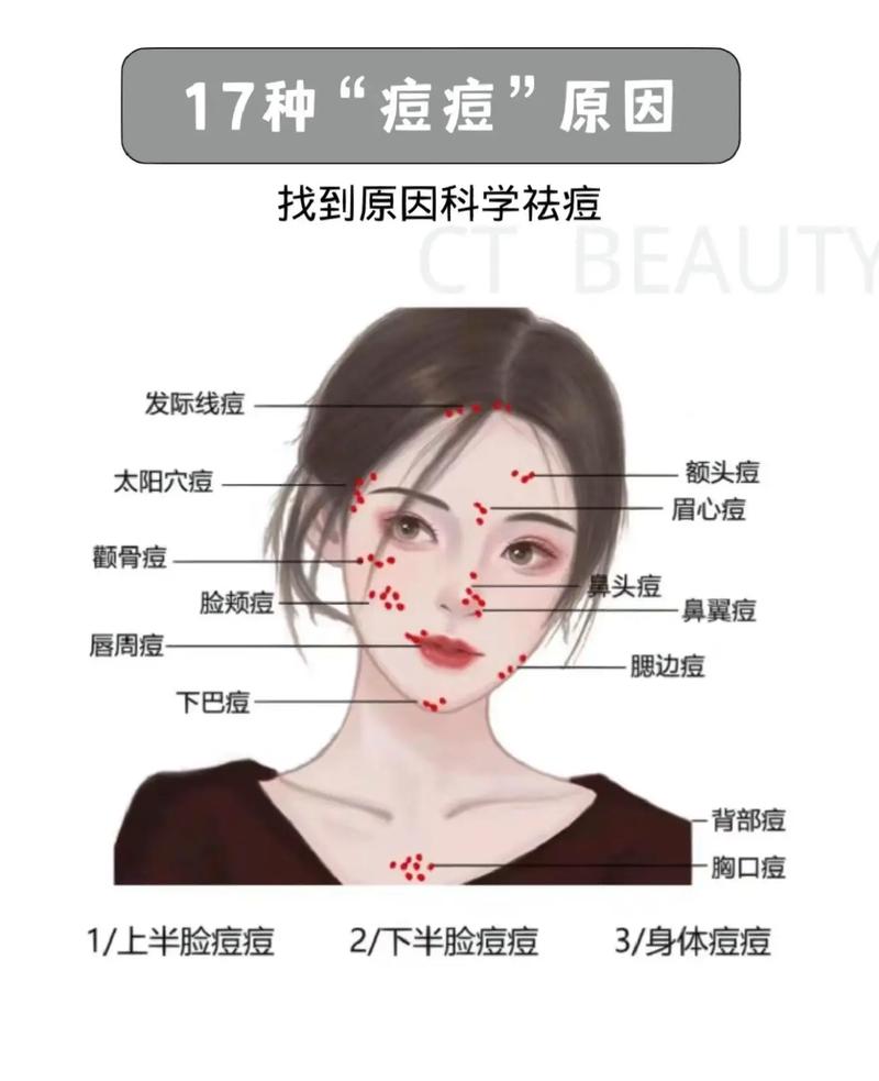 脸上长痘痘看什么科
