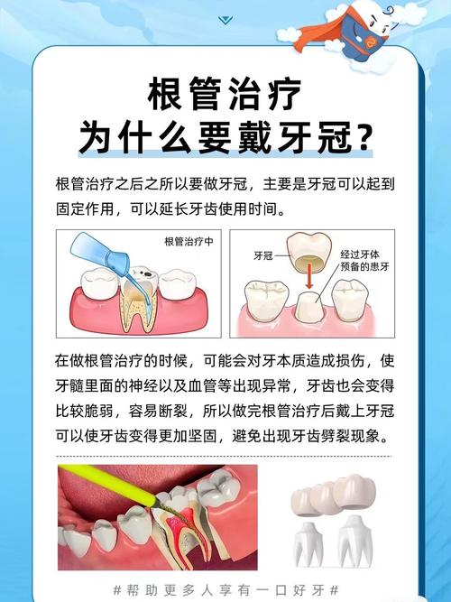 根管治疗要注意什么