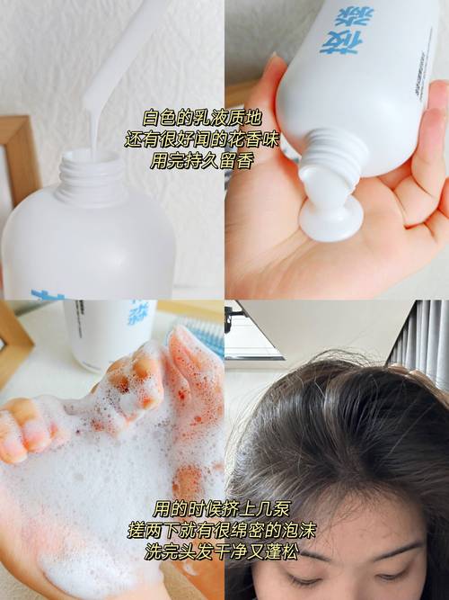 用什么洗头可以止痒