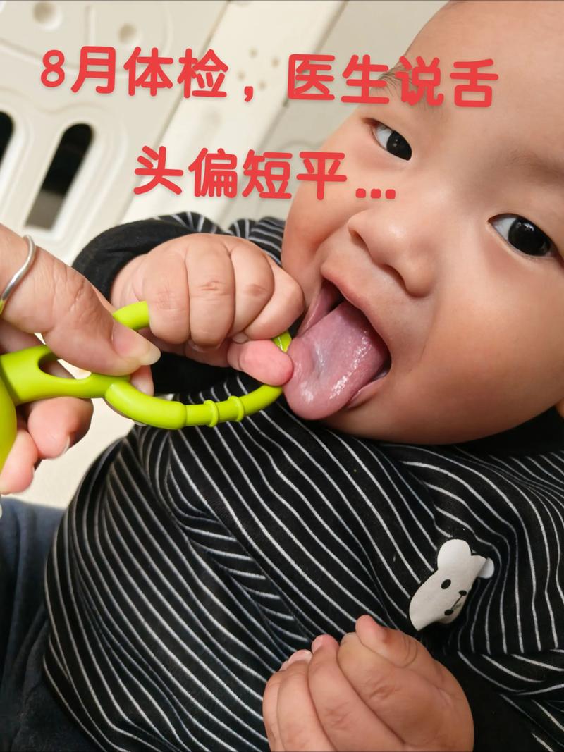 系带短有什么影响