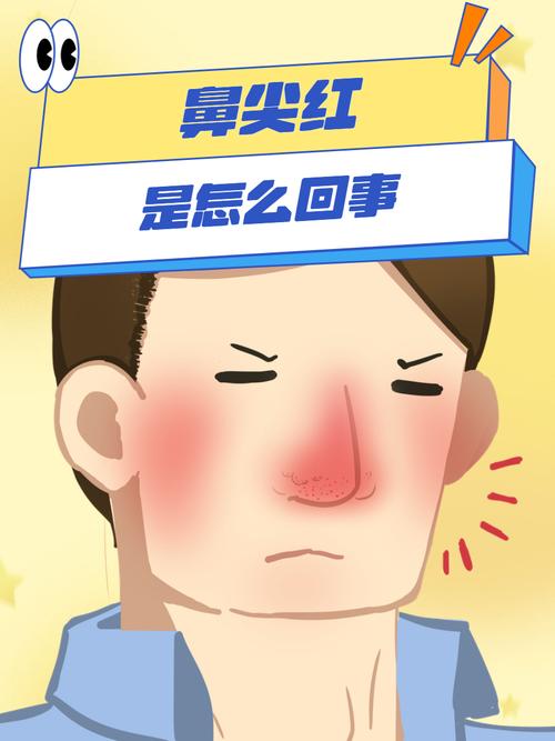 鼻子红为什么