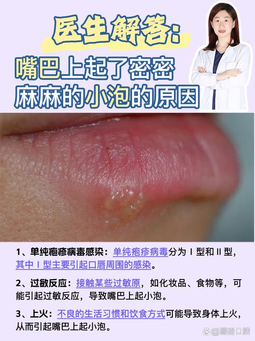 嘴边长痘是什么原因
