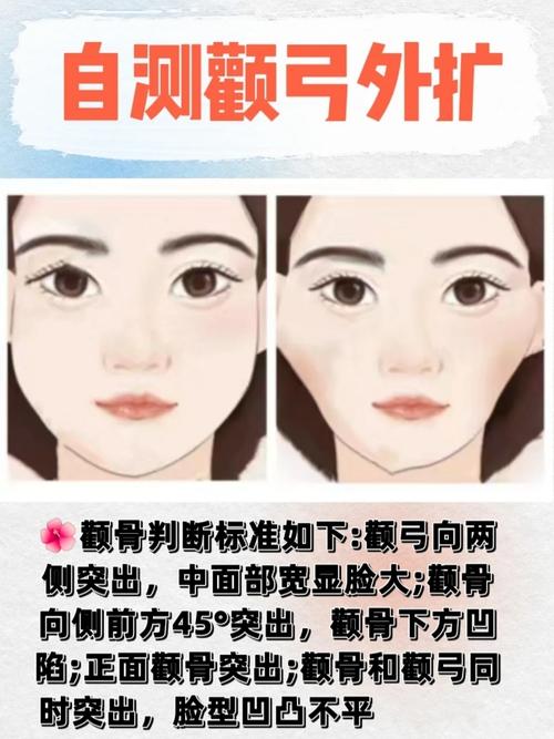 颧骨为什么会外扩