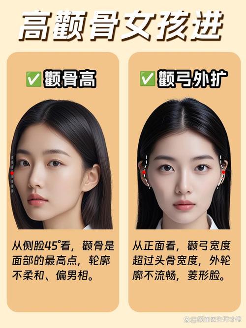颧骨为什么会外扩