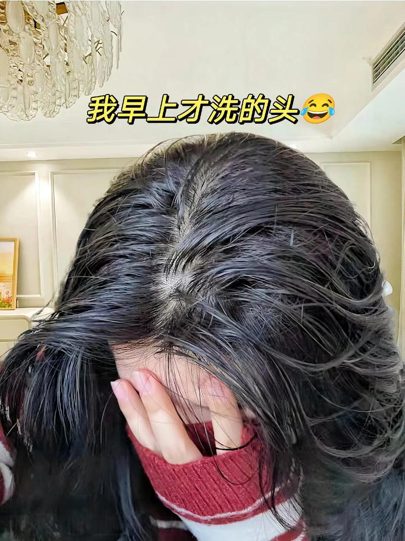 为什么头发油的很快