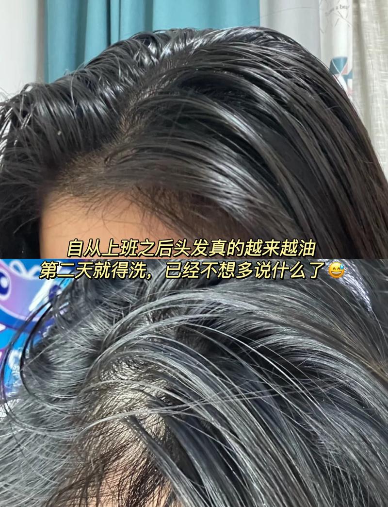 为什么头发油的很快