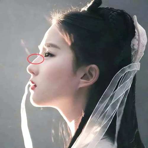 蒜头鼻长什么样