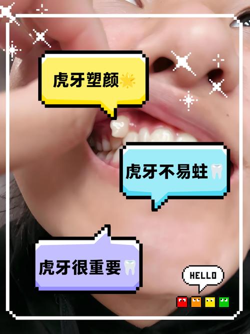 长虎牙是什么原因