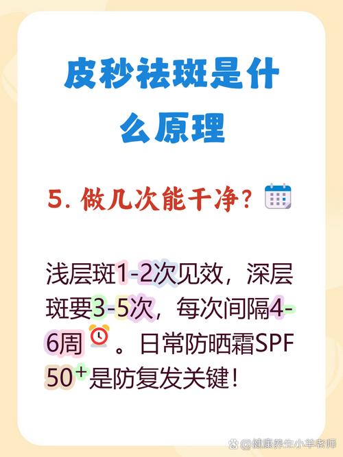 激光祛斑是什么原理