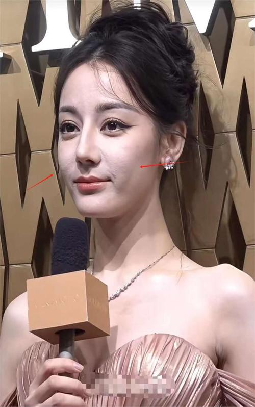 法令纹是什么样子