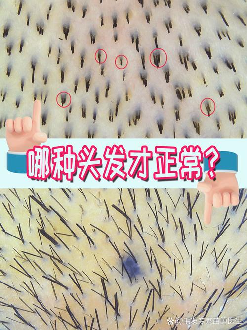 为什么头发很粗很硬