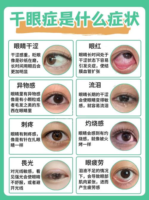 眼睛干涩是什么症状