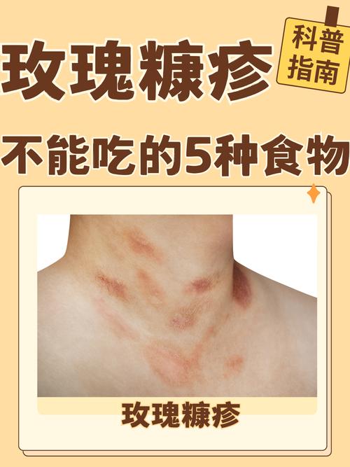 什么病引起皮肤瘙痒