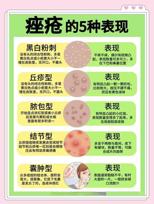 脸上为什么会长痤疮