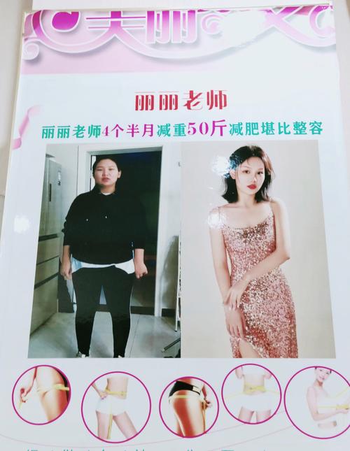 塑婷纤体通过什么减肥