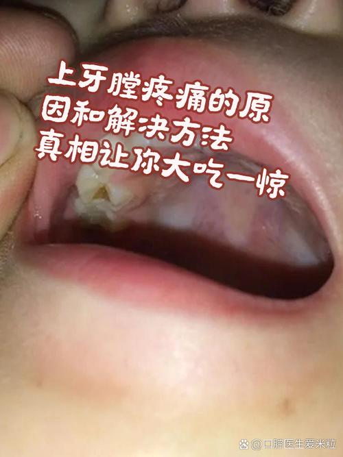 什么是牙口