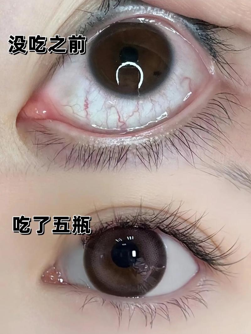 眼含什么
