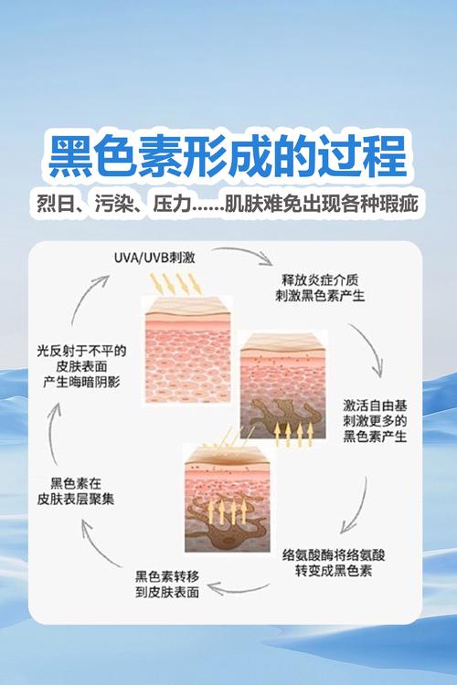 黑色素什么原因引起的