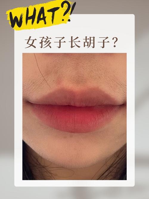 女孩子为什么长胡子