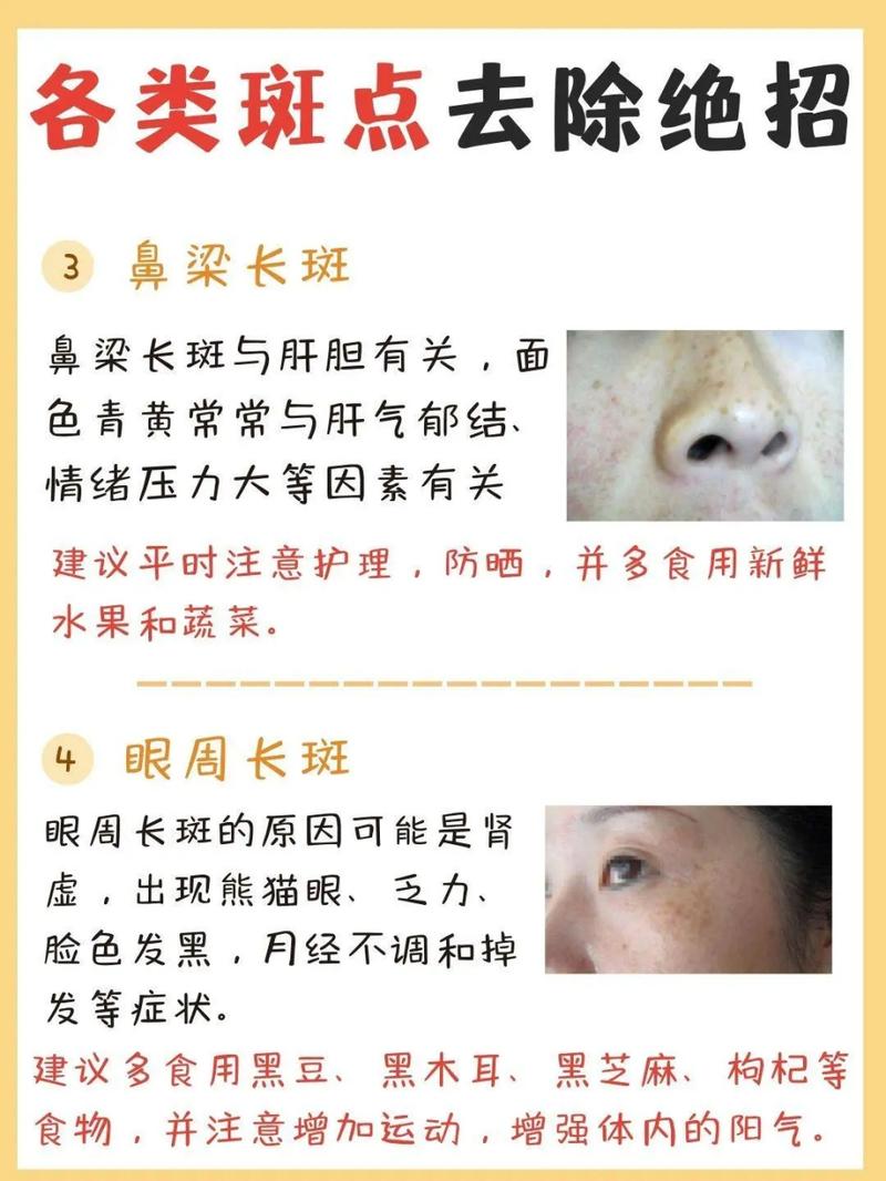 嘴唇长斑是什么原因