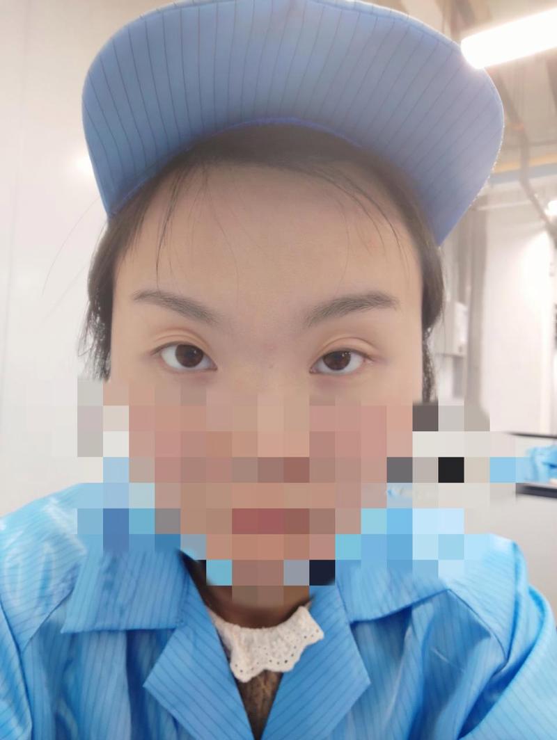 割双眼皮去什么医院