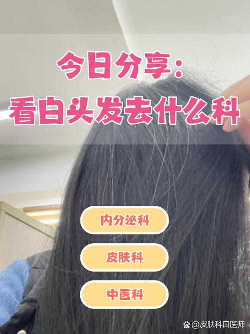 看白头发挂什么科