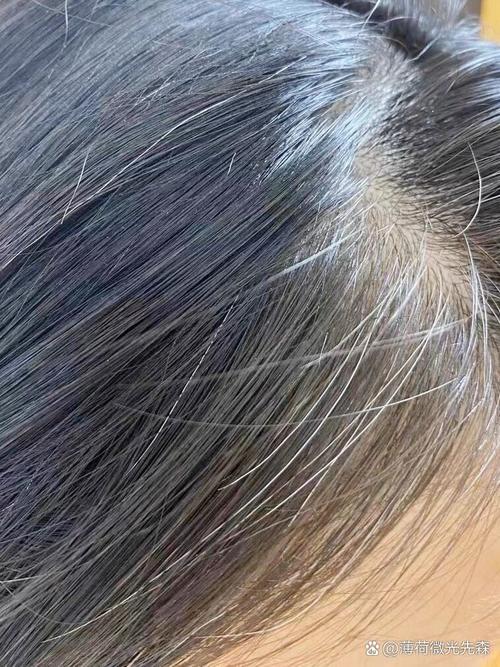 看白头发挂什么科