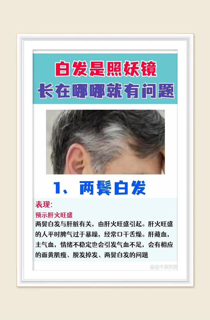 少年白是什么原因