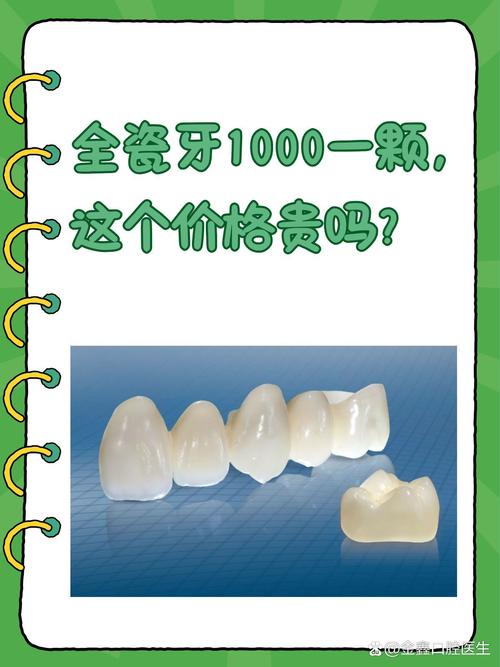 为什么整牙那么贵
