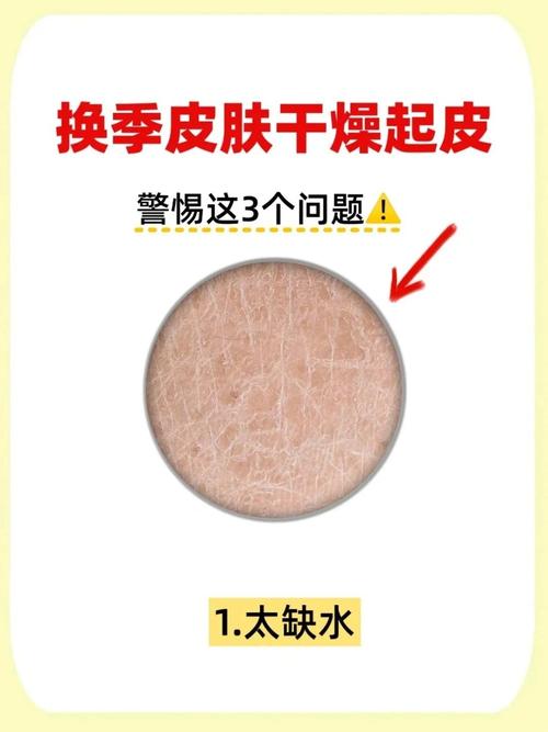 皮肤干燥起皮缺什么