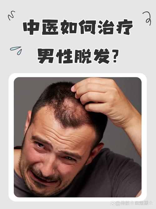 治脱发挂什么科