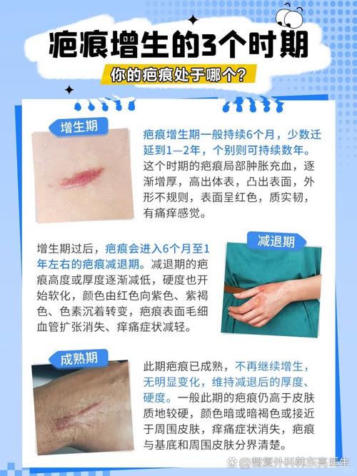 刀口为什么会增生