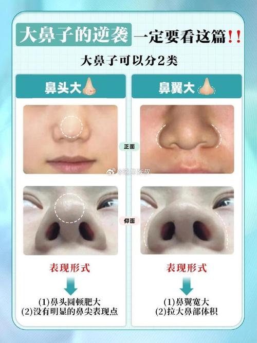 鼻子为什么大