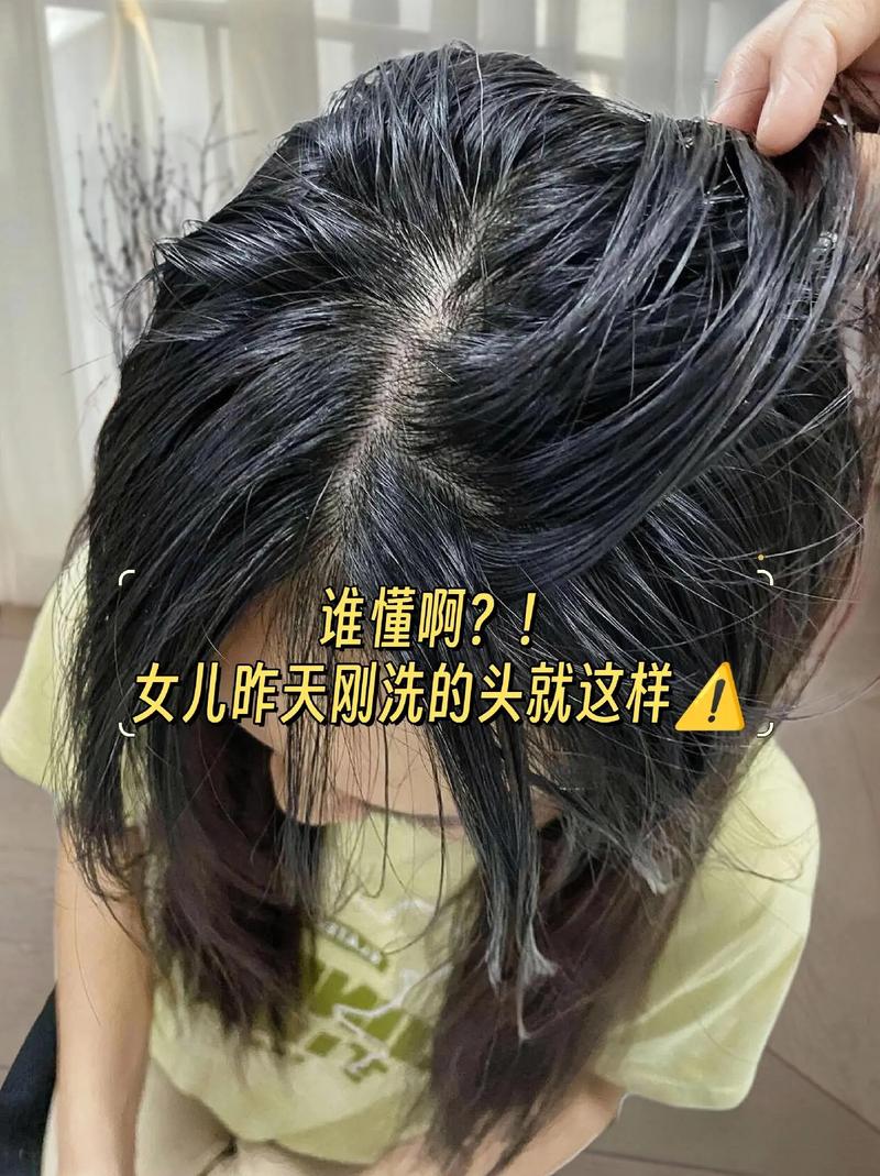 头发油多是什么原因