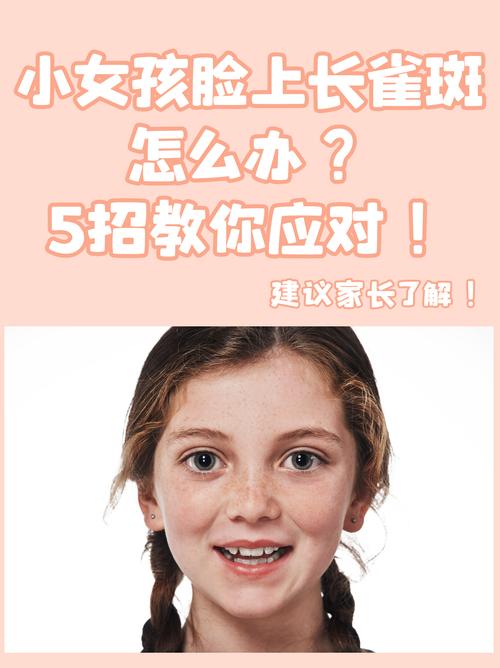 小孩长斑是什么原因