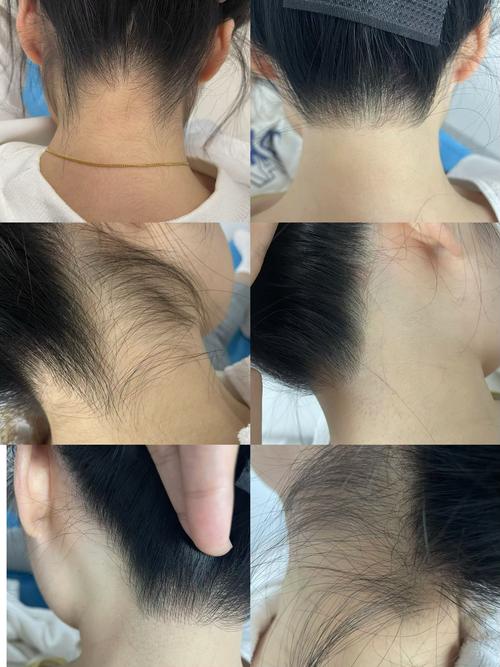 什么样的发际线好看