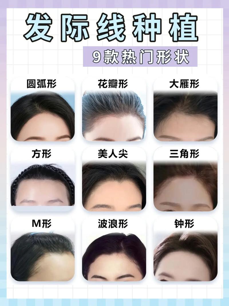 什么样的发际线好看