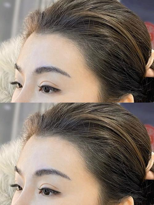 什么样的发际线好看