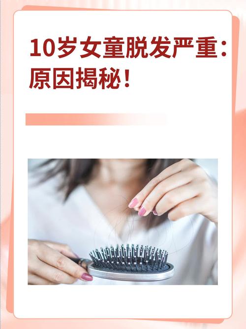 儿童脱发是什么原因