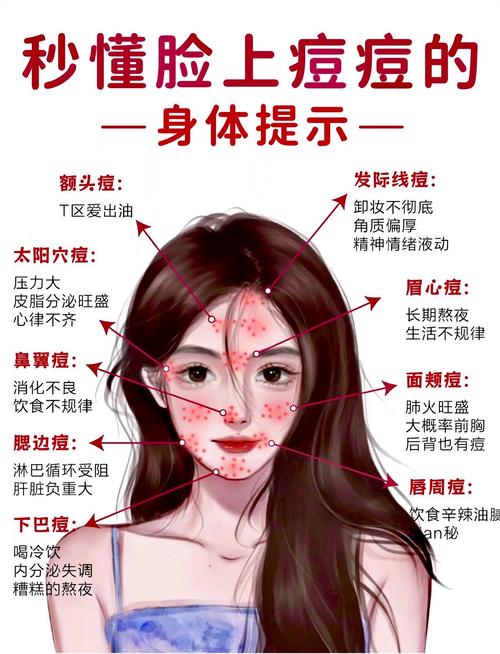 脸上长痘痘是什么病