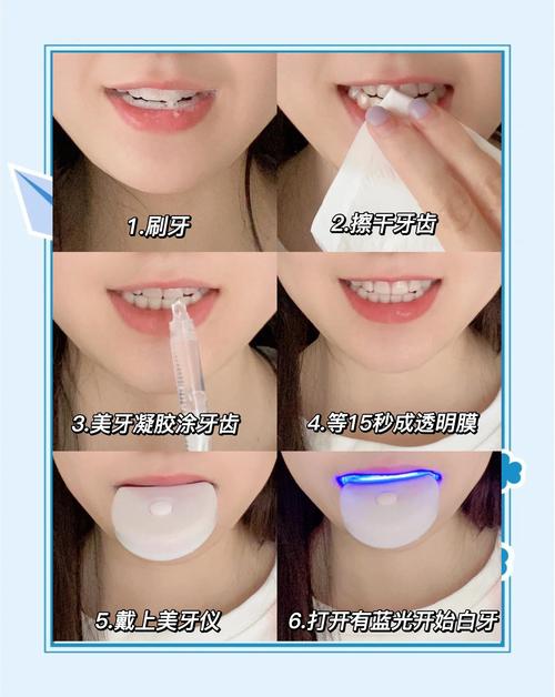 牙齿美白有什么方法