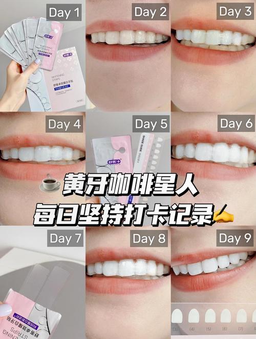 牙齿美白有什么方法