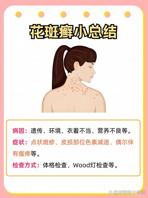 长汗斑是什么原因