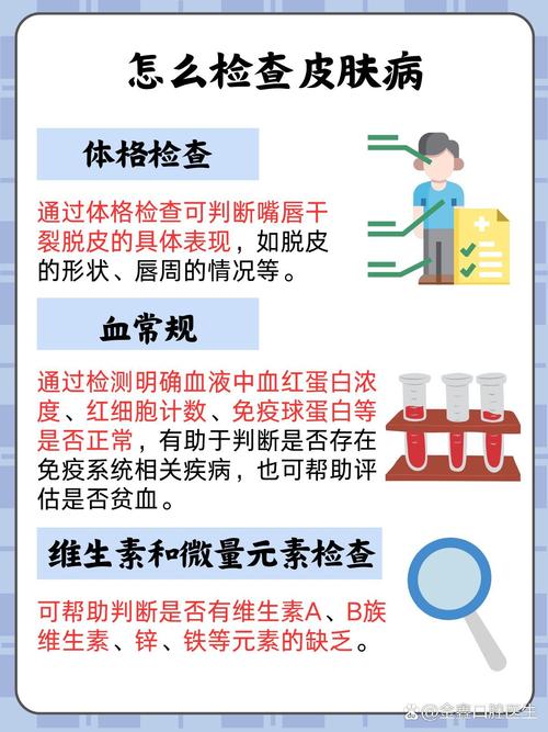嘴唇脱皮看什么科