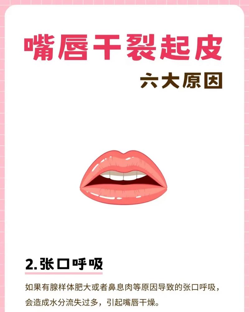 嘴唇脱皮看什么科