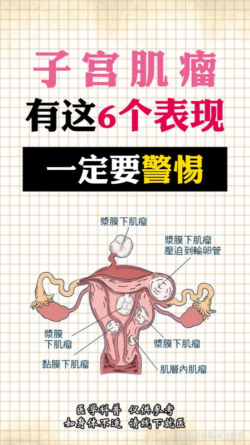 宫颈肌瘤什么症状