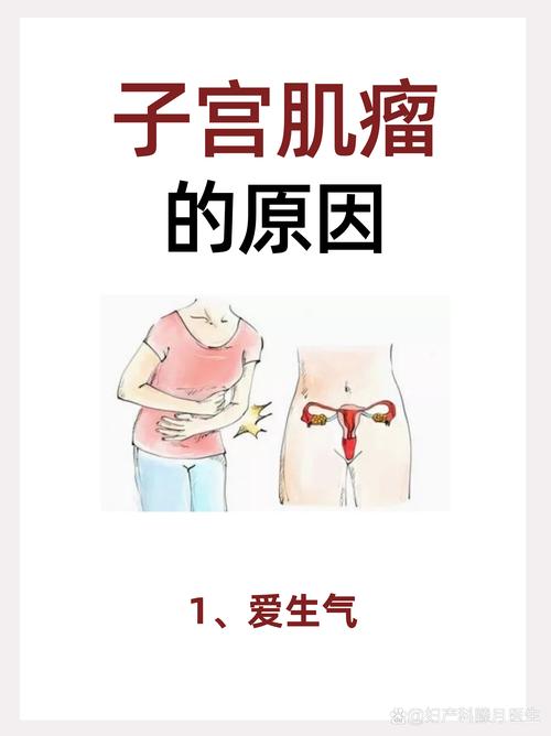 宫颈肌瘤什么症状