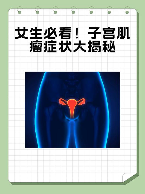 宫颈肌瘤什么症状