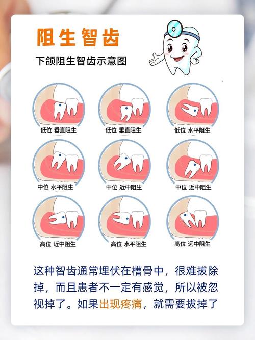 智齿属于什么科
